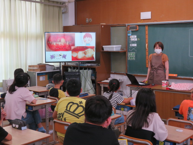 5年生歯の磨き方教室